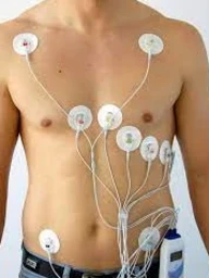 Холтеровское мониторирование сердечного ритма