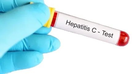Определение антител к антигена Hepatitis C virus (скрининг+тест)