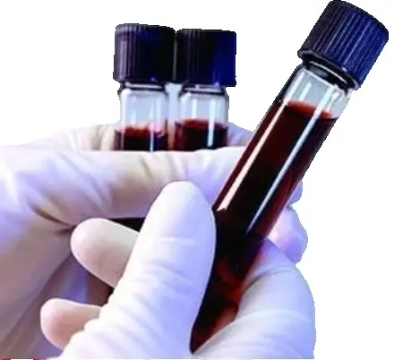 Исследование уровня калия в крови