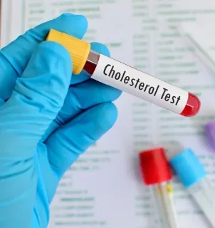 Фото для Анализ крови на холестерин общий (Cholesterol total)
